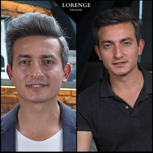 Lorenge — Champú en Barra Anticanas —  LLEVA 3 Y PAGA 2 (Promoción Exclusiva)