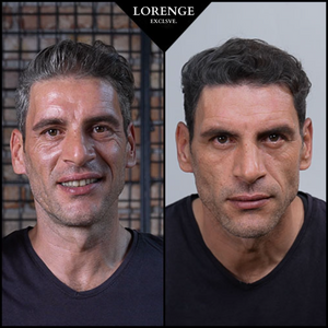 Lorenge — Champú en Barra Anticanas —  LLEVA 3 Y PAGA 2 (Promoción Exclusiva)